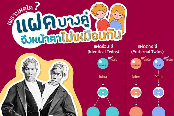 รูปประจำเรื่อง: เพราะเหตุใดแฝดบางคู่จึงหน้าตาไม่เหมือนกัน