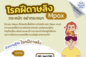 โรคฝีดาษลิง (Mpox): ตระหนัก อย่าตระหนก